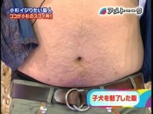 ブラマヨ小杉のお腹コブ