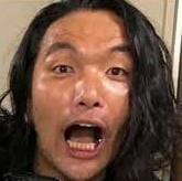 盛山晋太郎の銀歯